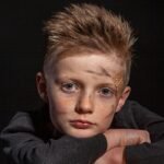 A captivating portrait of a boy with freckles and a band aid on his forehead, set against a dark background.